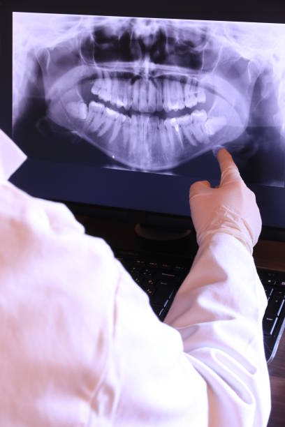 Best Tooth Infection Emergency Dentist  in Cherryland, CA